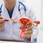 Polipi i miomi prepreka za trudnoću: Ginekolog otkriva kako histeroskopija vraća šansu za začeće shutterstock 2502097861