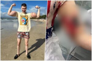 [Aggregator] Downloaded image for imported item #34245