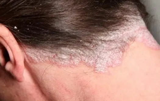 Neca Frizer širio šindru i tineu po Srbiji Nemanja Neca neca_frizer_