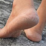 [Aggregator] Downloaded image for imported item #40931