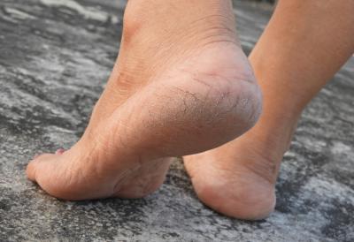 [Aggregator] Downloaded image for imported item #40929