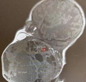 [Aggregator] Downloaded image for imported item #34347