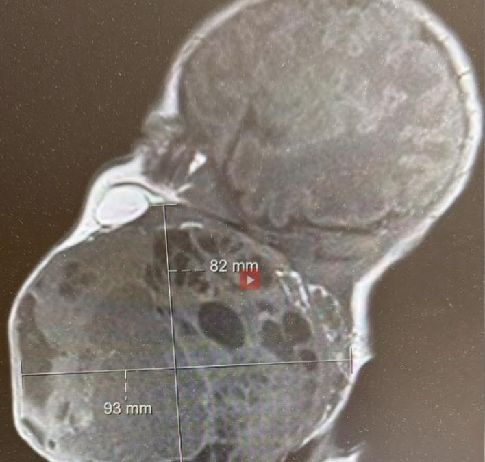 [Aggregator] Downloaded image for imported item #34347