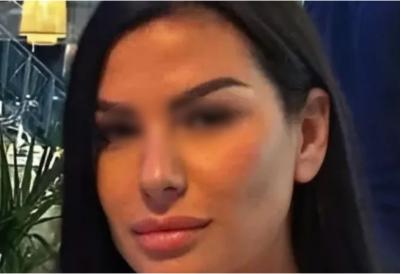 [Aggregator] Downloaded image for imported item #45154