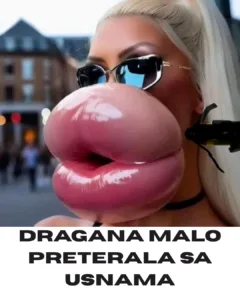 Dragana je malo preterala s usnama