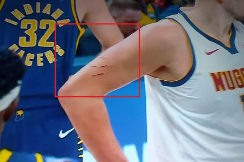 [Aggregator] Downloaded image for imported item #60104