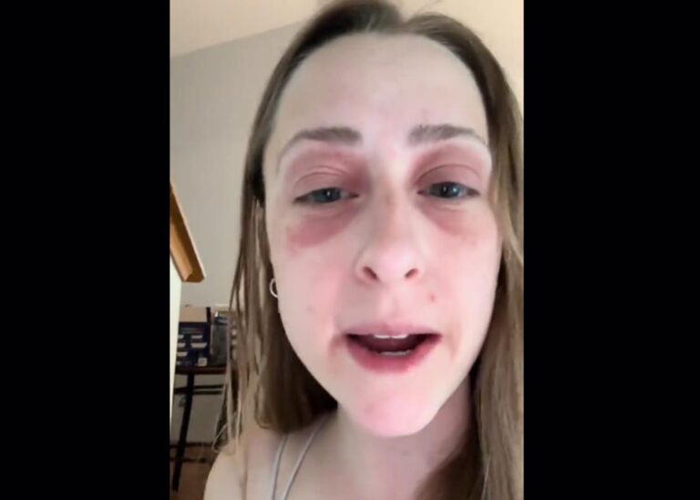 [Aggregator] Downloaded image for imported item #53361