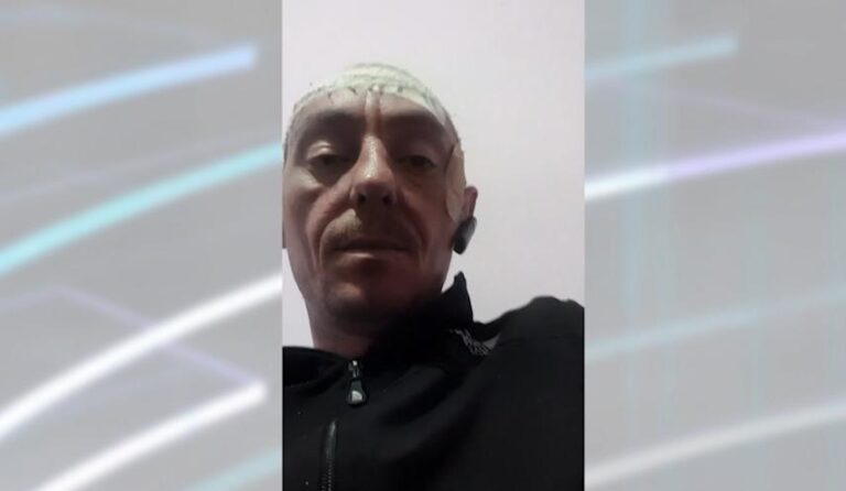 [Aggregator] Downloaded image for imported item #56948