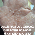 zbog nestručne šminkerke imam alergiju po celom telu nestručna šminkerka Milica Popadić Militsa for You