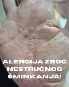 zbog nestručne šminkerke imam alergiju po celom telu nestručna šminkerka Milica Popadić Militsa for You