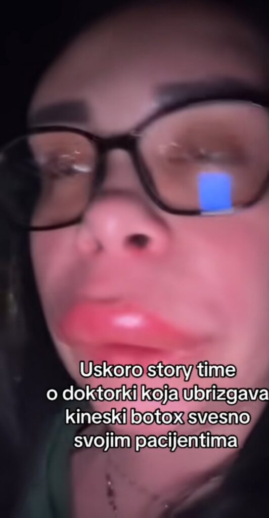  Katja Mitra kod nestrucnog lekara evo na &scaron;ta liči sada