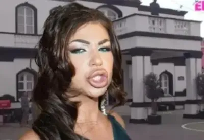 [Aggregator] Downloaded image for imported item #63389