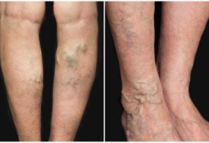 [Aggregator] Downloaded image for imported item #75730