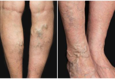 [Aggregator] Downloaded image for imported item #75730