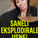 Šokantan ishod popularne influenserke — Saneli eksplodirale usne nakon previše hijalurona saneli eksplodirale usne zbog hijalurona