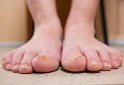 [Aggregator] Downloaded image for imported item #94307