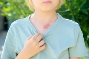 [Aggregator] Downloaded image for imported item #130596