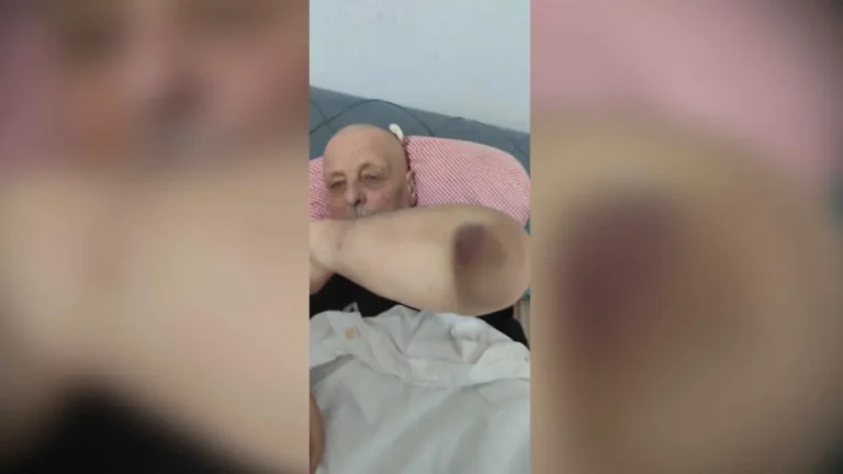 [Aggregator] Downloaded image for imported item #131978