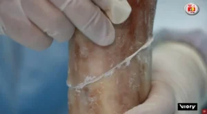 [Aggregator] Downloaded image for imported item #138275