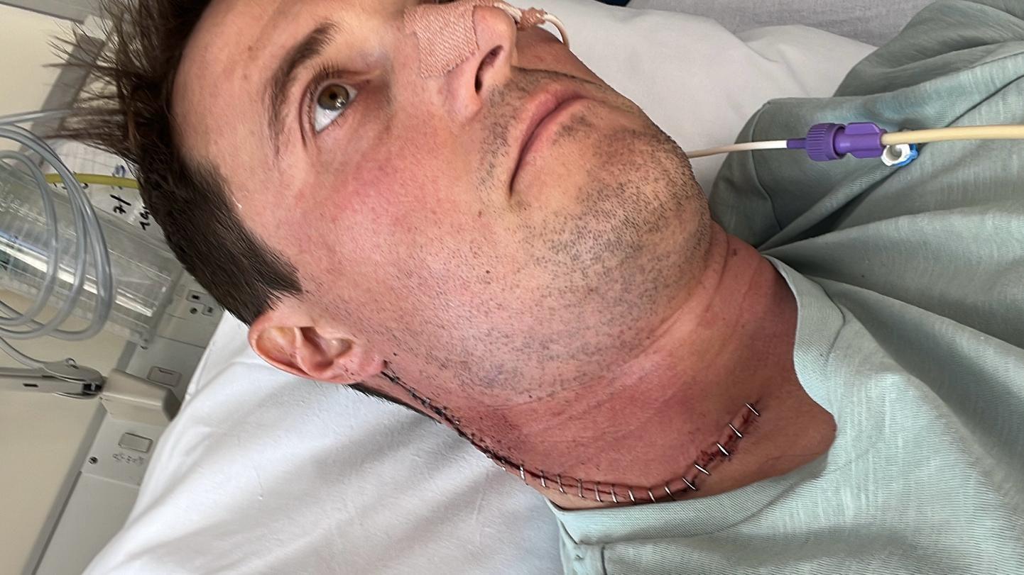 mu&scaron;karac leži u bolničkom krevetu sa cevčicom u nosu, na vratu mu je veliki ožiljak od operacije