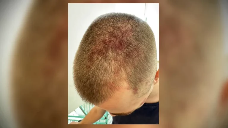 [Aggregator] Downloaded image for imported item #169338